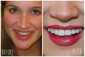 Hi, i wanted to know, when i use the turmeric powder to whiten my teeth, do i use the turmeric paste (turmeric and coconut oil) to replace my regular toothpaste for. How I Whiten My Teeth Naturally At Home Super Affordable Emily Kalbac