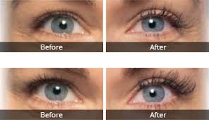 When applying latisse to the eyebrows it is recommended they are applied on a clean face after your skincare routine before bedtime. Latisse Eyelash Growth Ca Wa Tx Skinspirit
