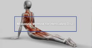 mckenzie method for herniated disc dr