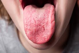 tongue disease health clues hiding on