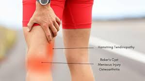 knee pain running back of knee pain