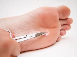 toenail cutting cardiff