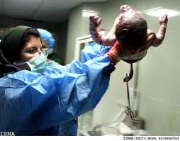 Image result for تولد نوزاد