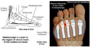 Image result for foot pad anatomy