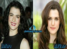 Brief details about her surgery rumors are discussed after her biography . Rachel Weisz Plastic Surgery Before And After Plastic Surgery Facts