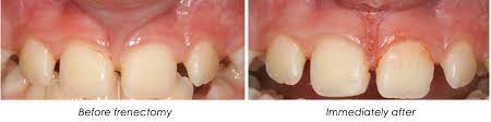 anderson periodontal wellness