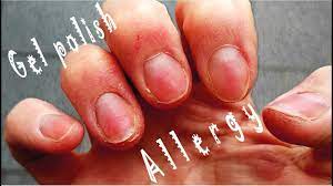nail gel polish allergy you