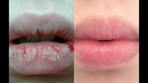 diy lip scrub how to exfoliate lips