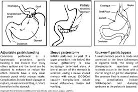 the effect of bariatric surgery on
