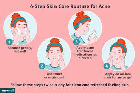 how to treat acne when you have dry skin