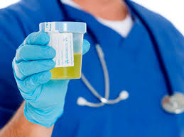 Urine Glucose Test Purpose Procedure And Results