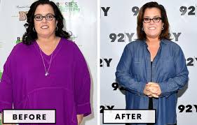 top 21 celebrity bariatric surgery