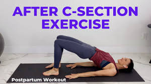 after c section exercise postpartum