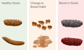Stools with blood can be caused by many different conditions. Poo Chart Reveals What S Normal And What Could Be A Warning Sign Of Cancer Daily Mail Online