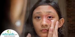 fungal eye infections causes symptoms