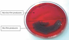 Plates were inoculated and incubated for 24 hours at 37°c. Jcdr Biofilm Uropathogens The Tube Adherence Method The Congo Red Agar Method