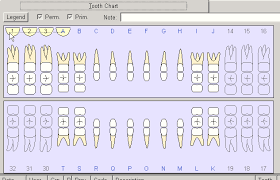 Tooth Chart Primary Vs Permanent Interdent It