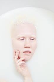 premium photo serene albino woman