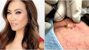Watch full episodes, get behind the scenes, meet the cast, and much more. Dr Pimple Popper Is Getting Her Own Reality Series On Tlc