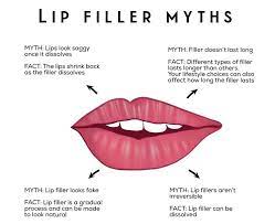 how to get perfect lip fillers improve