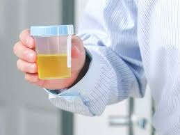 white particles in urine pregnancy