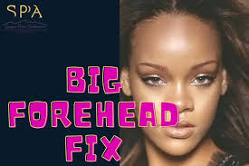 forehead reduction surgery