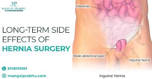 long term side effects of hernia surgery