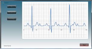 Real Time Visualization Of Bipolar Ecg On Desktop Device In