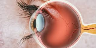 inconuous eye disease
