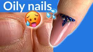 oily nails hyperhidrosis