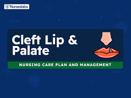 cleft palate nursing care plans