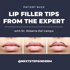 patient buzz lip filler tips from the