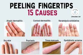 skin ling on fingertips 15 causes