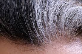 remes for white hair in young age