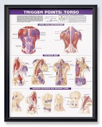 Trigger Points Torso And Extremities Chart Set 20x26 Clinicalposters