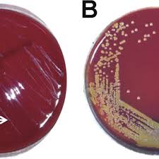 Гидролизат казеина, ферментный гидролизат из животных тканей. Small Colony Variants Compared With Normal Colonies A Blood Agar Download Scientific Diagram
