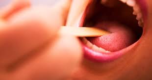 hiv tongue and symptoms