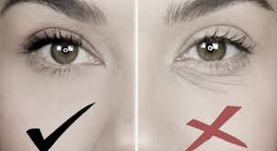 remove under eye wrinkles naturally