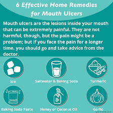 mouth ulcers their symptoms causes