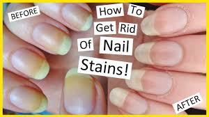how to remove nail polish stains you